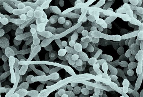 Biofilm Basics - What It Is and What Is Its Purpose