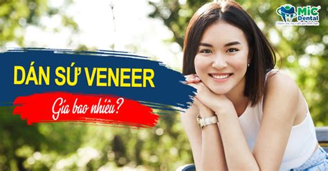 Dán Sứ Veneer Cùng 4 Yếu Tố Quyết Định Giá