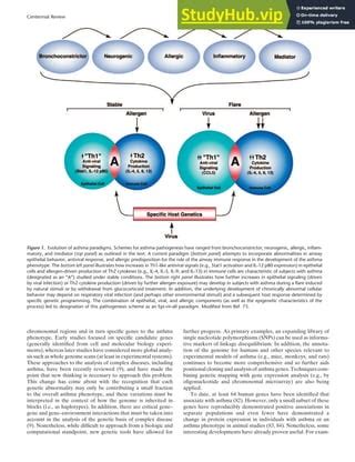 A Centennial History Of Research On Asthma Pathogenesis | PDF