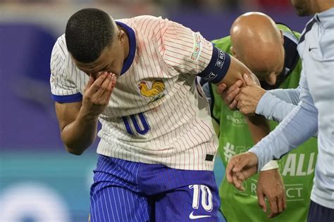 Euro Kylian Mbappe Berlumuran Darah Saat Prancis Mengiris Tipis