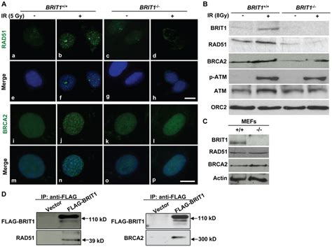 BRIT1 Is Required For Recruitment Of RAD51 BRCA2 To The IR Induced DNA