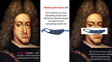 The Habsburg Jaw: The Royal Deformity Caused By Centuries, 50% OFF