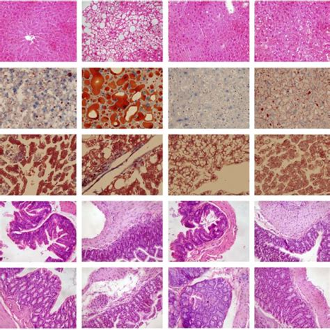 Histopathological Staining Of Liver Ileum And Colon Tissues