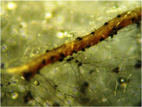 Pycnidial Macrophomina phaseolina structures (100-200 µm) of fungi on... | Download Scientific ...