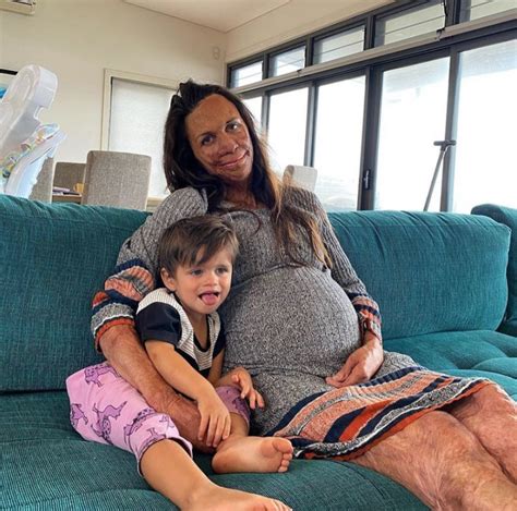 Why Turia Pitt Is One Of Australia S Most Inspirational Women Mama