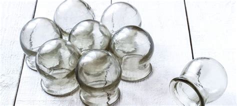 Cupping | The many benefits of Chinese medicine cupping