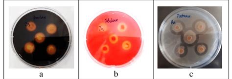 Gambar Hasil Uji Aktivitas Enzim Ekstraseluler Yang Menunjukkan Zona