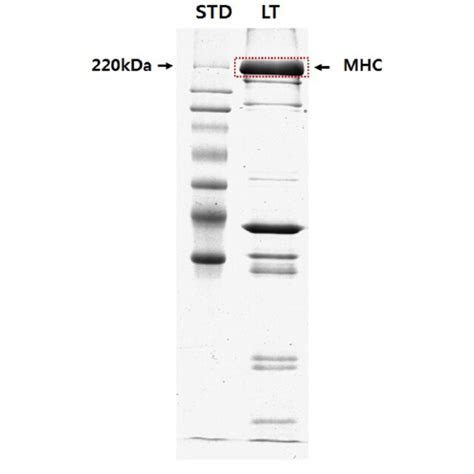 The Result Of One Dimensional Gel Electrophoresis For Separate The