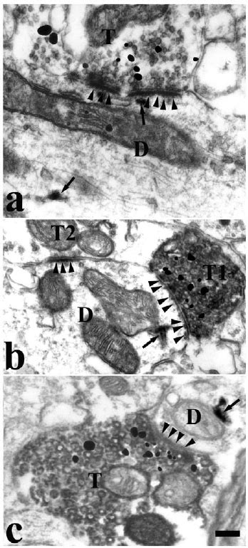 Electron Micrograph Showing The Synapses Between The BDA VGluT2