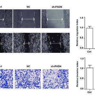 Knockdown Of Padi Inhibits The Migration And Invasion Ability Of A