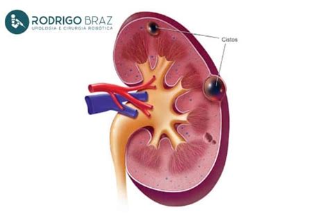 Principais Exames Solicitados Pelo Urologista Entenda A Import Ncia De