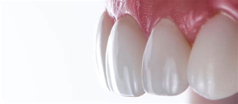 Zirconium Veneers In Izmir Turkey Cost And Reviews