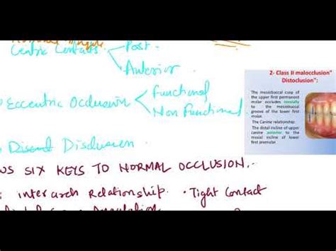 Centric Contact Eccentric Occlusion Disclusion For Bds Students By