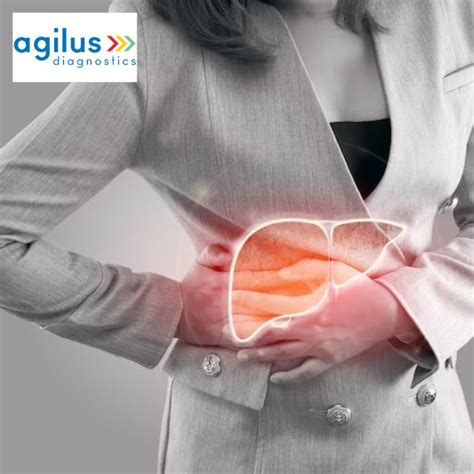 Agilus Diagnostics