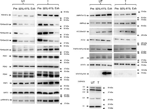 Representative Western Blots Of Pdh E1α Pdhser293 Pdhser300 Download Scientific Diagram