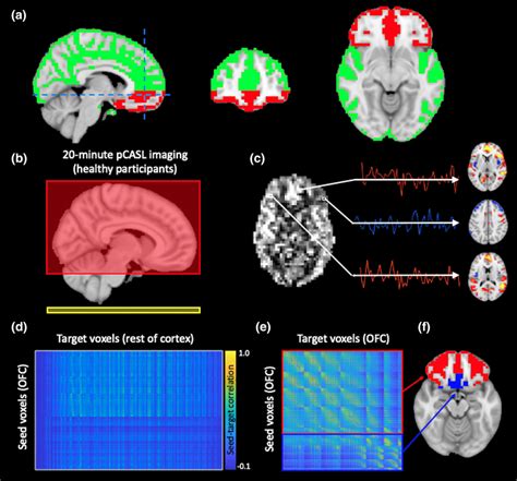 Study overview. (a) Orbitofrontal cortex (OFC, red) and whole‐brain ...