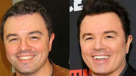 Seth Macfarlane Might Have Received Plastic Surgery To Look Younger