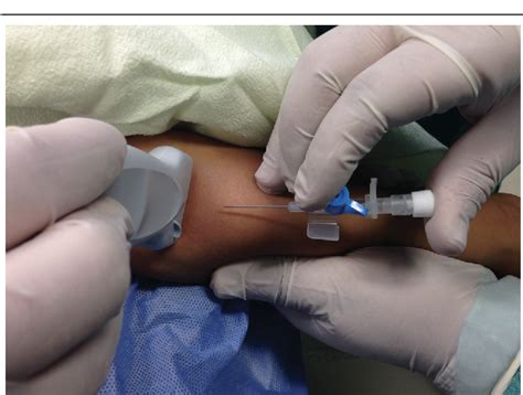 Ultrasound Guidance Versus Transillumination For Peripheral Intravenous