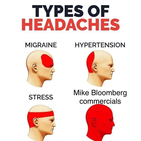 Headache Chart: What Does Headache Location Mean?