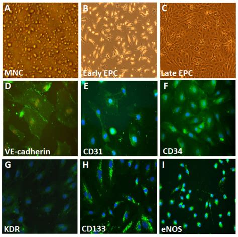 Morphology and characterization of human endothelial progenitor cells ...