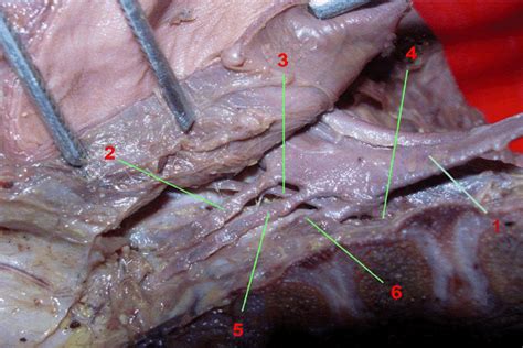 Dissection For The Right Pelvic Side Showing The Inferior Gluteal