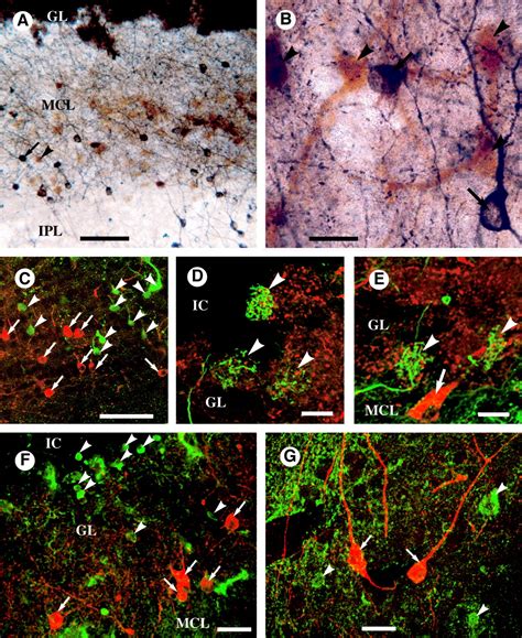 Label The Photomicrograph Based On The Hints Provided Glomerulus Of