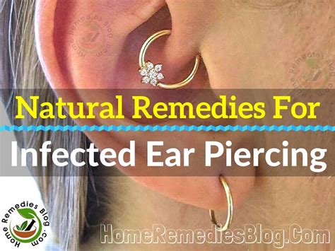 13 Proven Natural Treatments For Infected Ear Piercing Home Remedies Blog