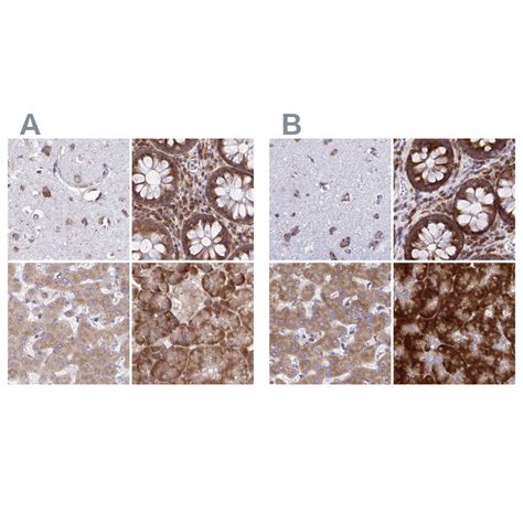 Rabbit Polyclonal Anti-RPS15 Antibody - Buy for research - Highly ...