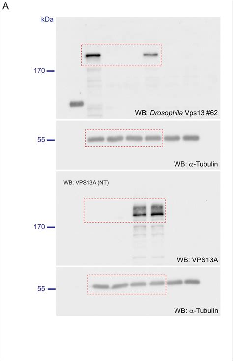 Figures and data in Human VPS13A is associated with multiple organelles ... 