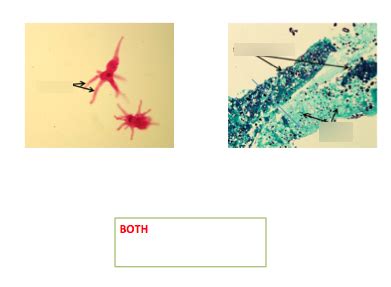 Lab Protist Fungi And Lichen Slide Diagram Quizlet