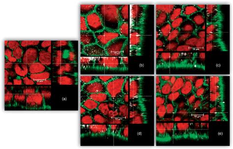 Uptake Adhesion Of AgNPs After 24 H Exposure Confocal Microscopy