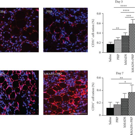 PRP Treatment Improves The Healing Potential Of Human MSC HMADS Cells