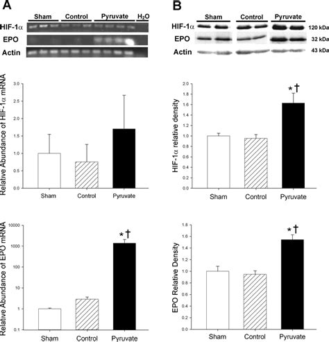 Hypoxia Inducible Factor HIF 1 And Erythropoietin EPO MRNA