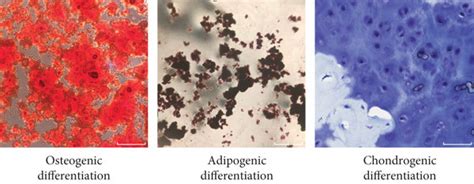 Identification Of Nucleus Pulposus Derived Mesenchymal Stem Cells Download Scientific Diagram