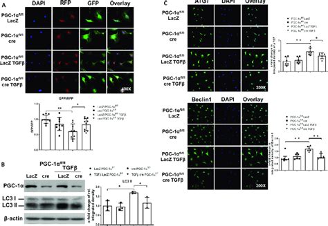 Peroxisome Proliferator Activated Receptor Gamma Coactivator