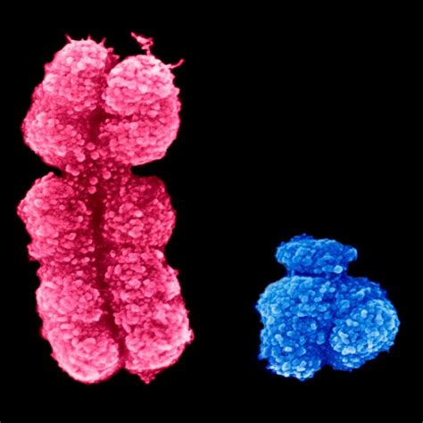 Rna Sequencing Provides New Insights Into Infertility Causing Sex Chromosome Disorders Rna Seq