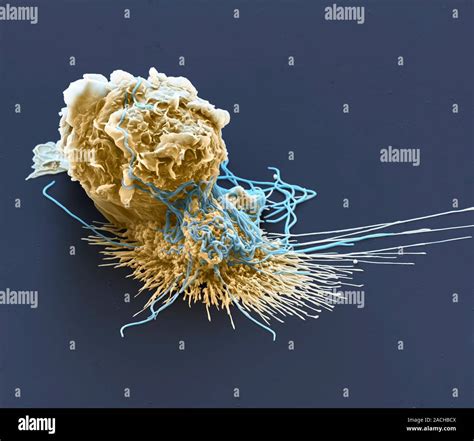 Macrophage Engulfing Bacteria Coloured Scanning Electron Micrograph