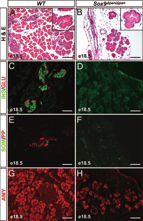 Pancreatic growth and cell differentiation require SOX9 activity ... 