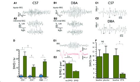 Heterozygous Ko Causes Swds And Absence Like Seizures Sample Eeg Download Scientific Diagram