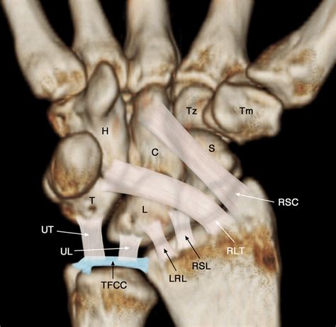 Schematic Diagram Of Volar Extrinsic Wrist Ligaments Rsc Volar