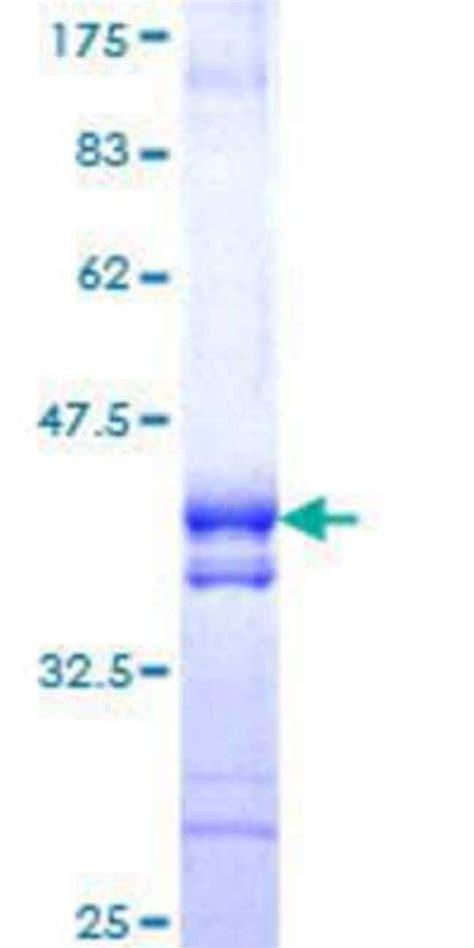 Novus Biologicals Recombinant Human NPLOC4 GST N Term Protein 10 μg