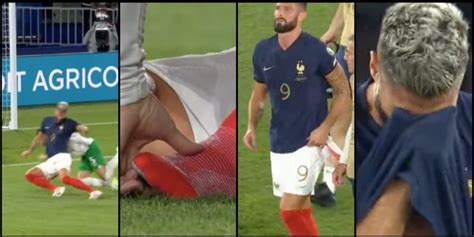 Giroud ko Milan in ansia infortunio con la Francia cos è successo