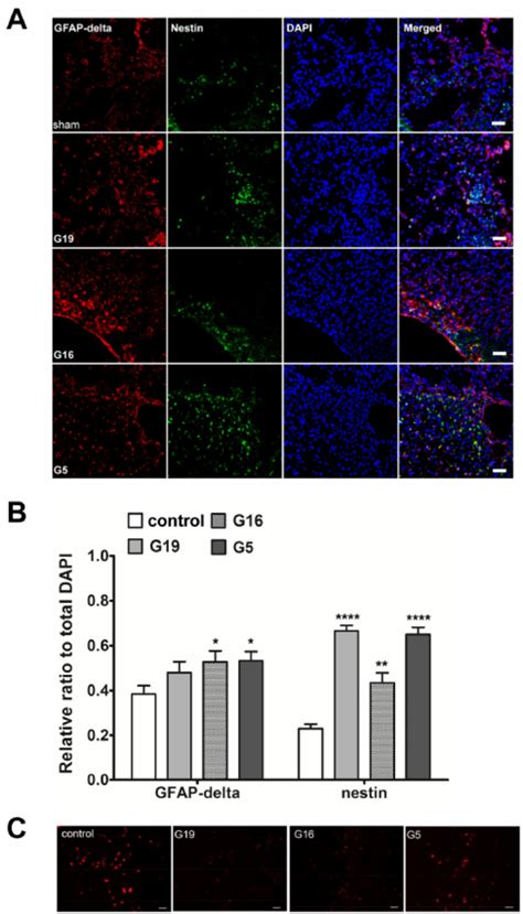 Neurogenesis In The Ischemic Brain Hucb Mscs May Induce Post Ischemic