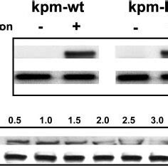 Conditional Expression Of Kpm Protein In HeLa Tet Offkpm Wt And Kpm Kd