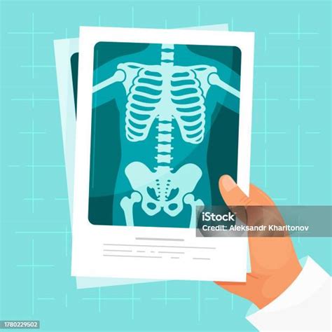 X Ray Medical Roentgen Human Body Skeleton Diagnostic Image In Male Doctor Hand Vector Flat