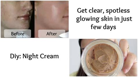 Get Clear Spotless Glowing Skin In Just Few Days Diy Night Cream