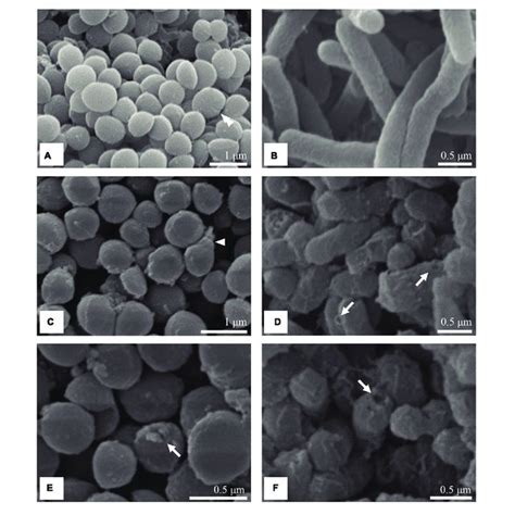 Sem Micrographs Of Untreated And Treated S Aureus And S Enteritidis