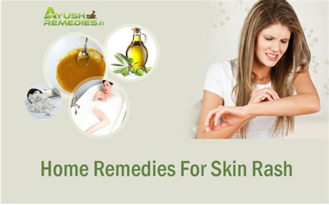 8 Best Home Remedies for Skin Rashes - Herbal And Effective Treatment