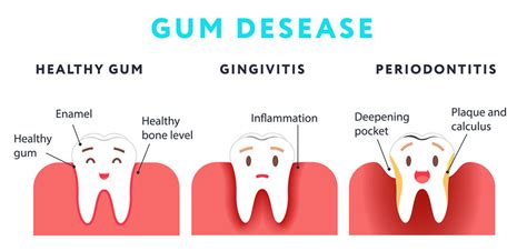 Loose Adult Tooth Here S What To Do