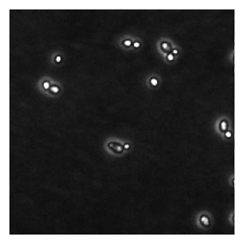 Microscopic Analysis Of C Albicans Hyphal Growth In Vitro Yeast Form Download Scientific